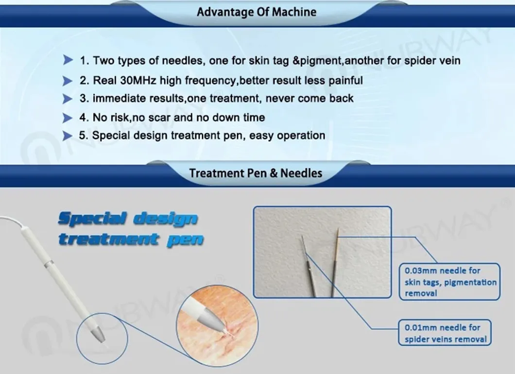 Vascular Removal Before After Clinical