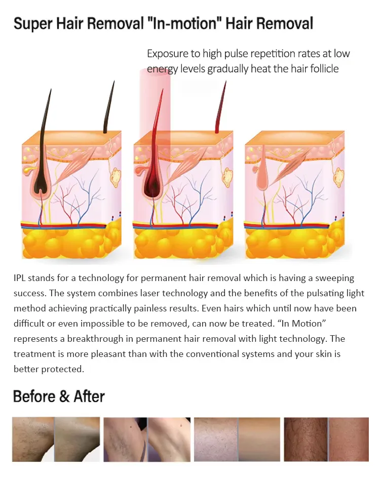 Treatment Performance