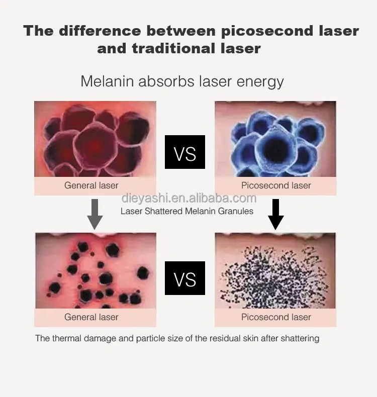 Laser Treatment Detail 2