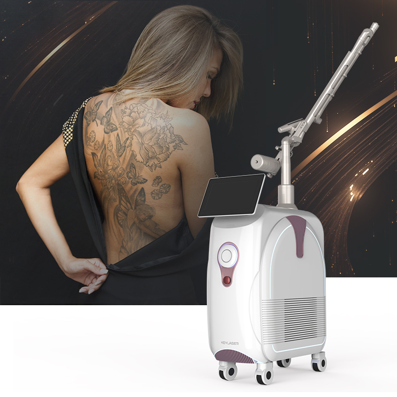 Keylaser Professional Picosecond Laser Tattoo Removal Beauty Machine for Pigmentation and Acne Removal