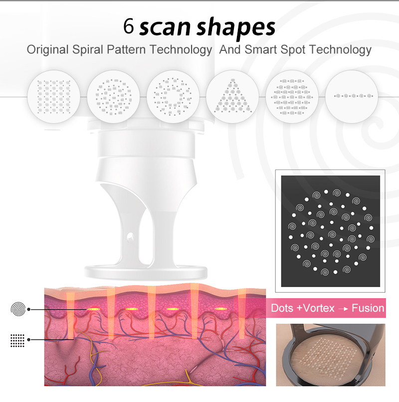 Laser Technology