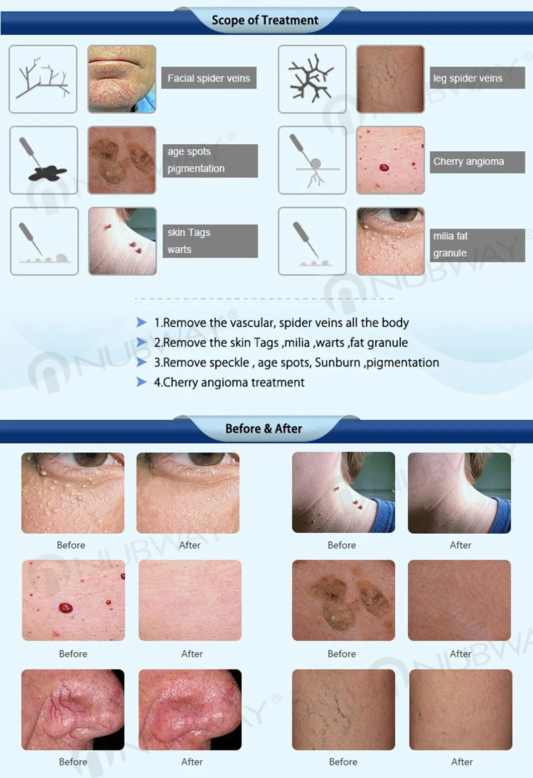 Handpiece and Accessories Overview