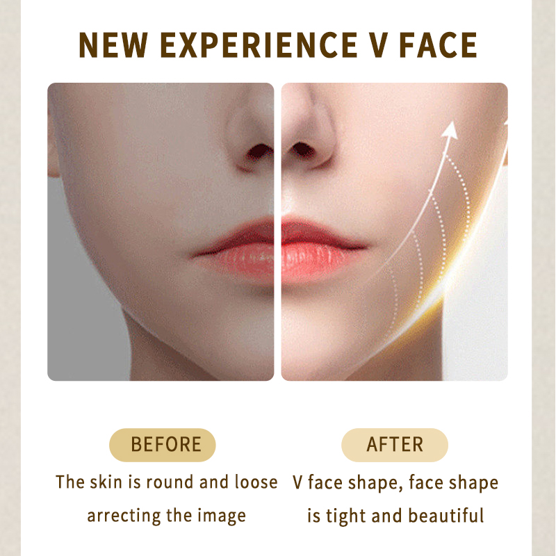 2025 Hot Sale Portable Beauty Device for Removing Wrinkles - Professional Model - Rechargeable with Long Battery Life