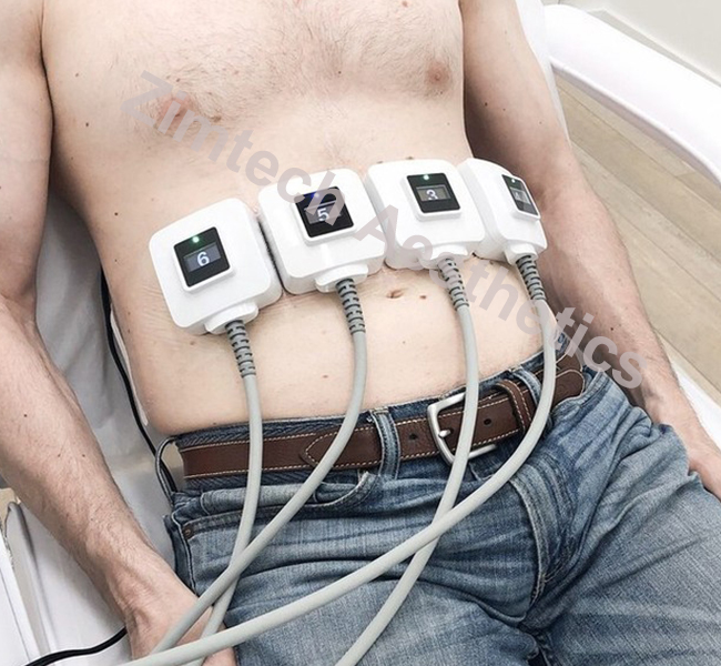 2024 Portable Trusculpt Body Sculpting Deep Dissolving Fat Slimming Machine Cellulite Reduction Machine