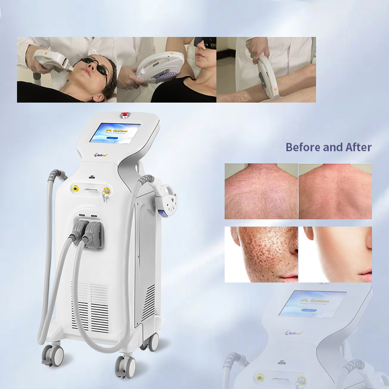 IPL Hair Removal and IPL Pigmentation Removal Beauty Machine (HS-650(IPL+RF))