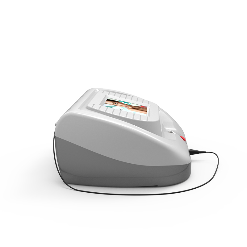 30MHz Rbs Vascular Lesions Pigmentation Vascular Removal Vein Wave Machine