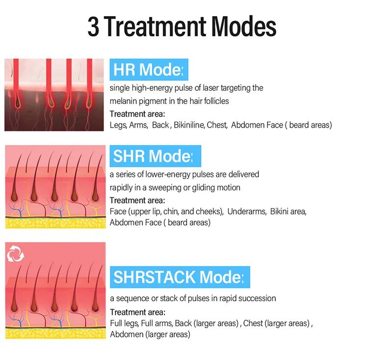 Advanced Diode Laser Handle