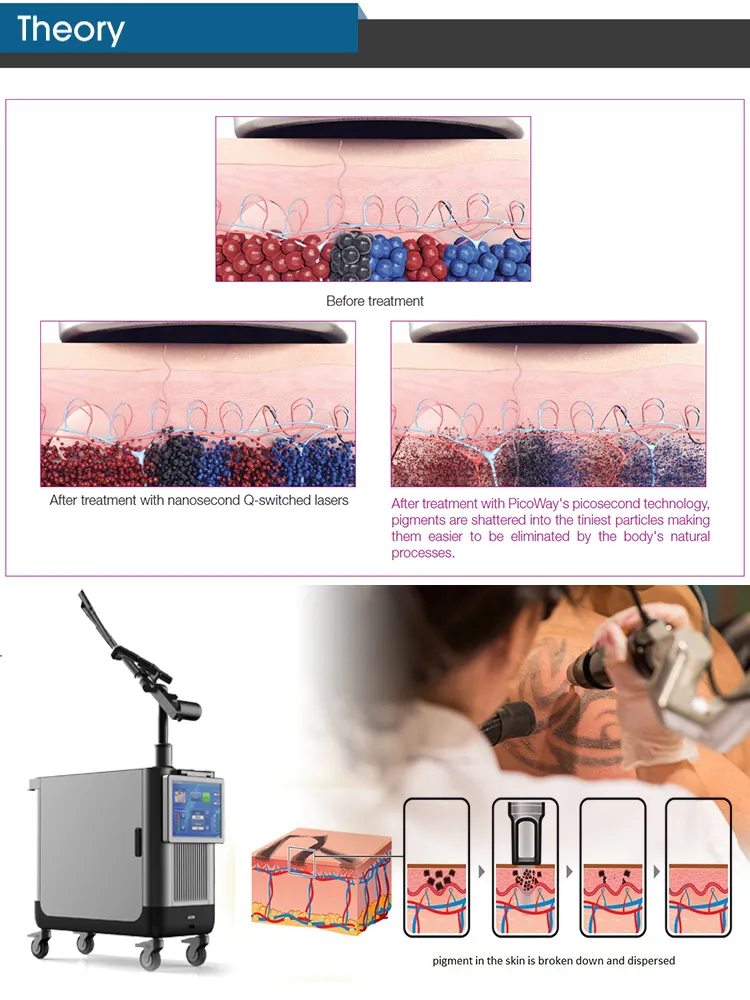 Picosecond Laser Pico Laser Tattoo Removal Skin Whitening Machine
