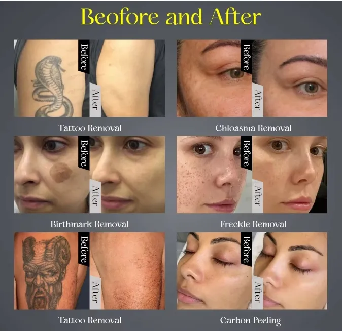 Treatment Result 2
