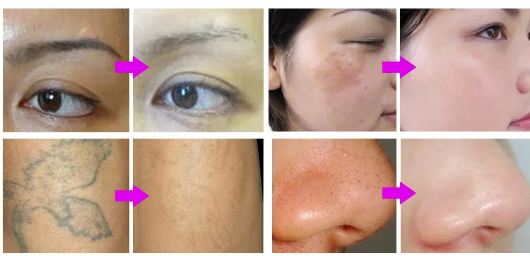 Treatment Results 1