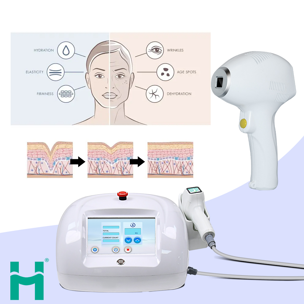 Portable Fractional Handle OEM 1470nm Diode Laser Wrinkle Removal Skin Tightening 1470 Laser Wrinkle Removal Machine