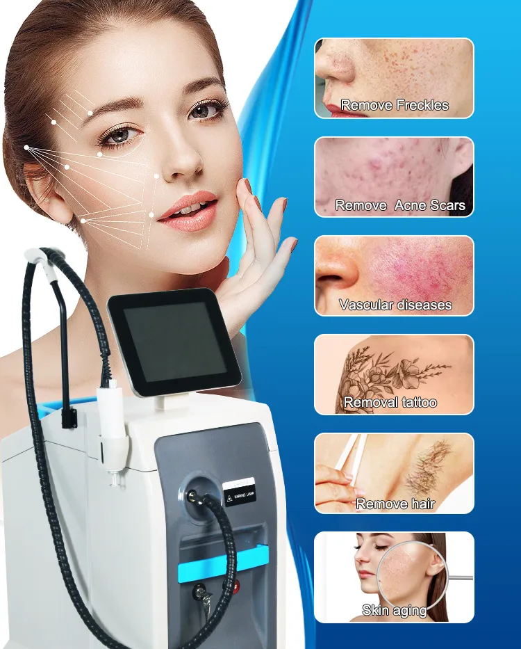 Treatment 3