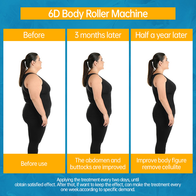 Z For Therapy Machine Cellulite Reduction &amp; Body Slimming Roller Massage Lymphatic Drainage Contouring For Spa Grade Use