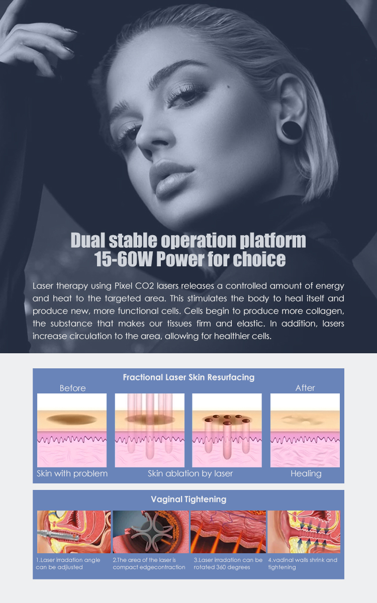 CO2 Fractional Laser Details 4