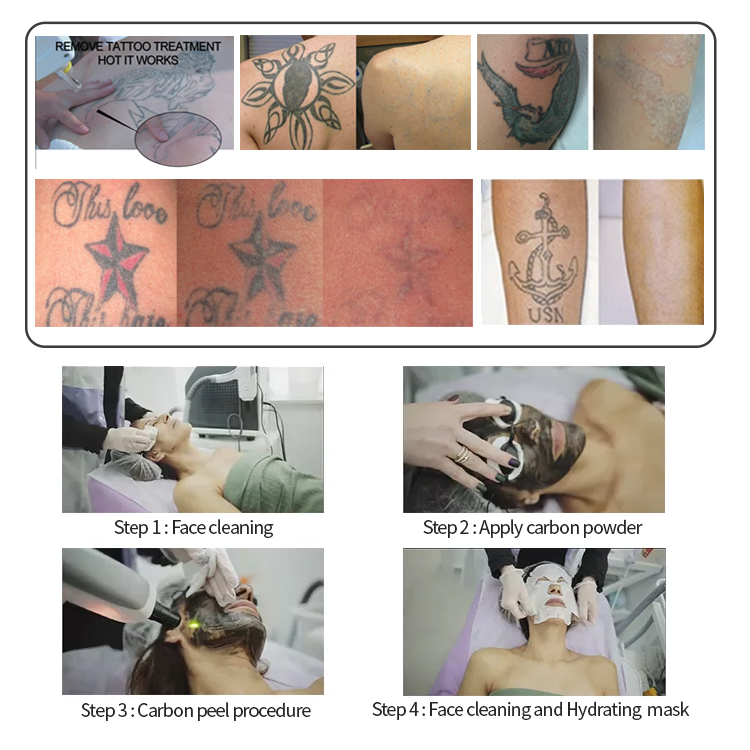 Treatment Result