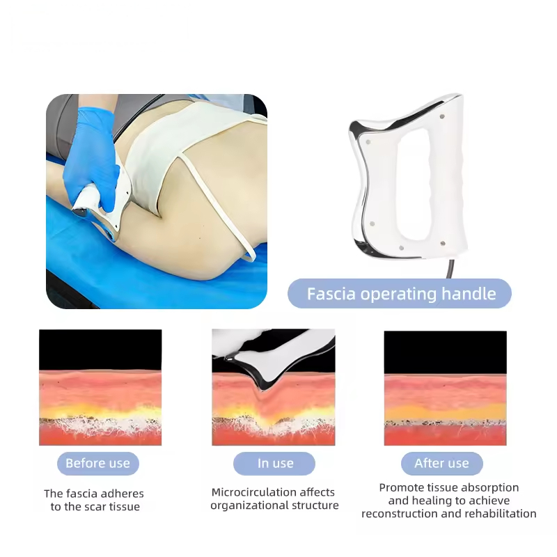 Factory Price 448k Physical Therapy Skin Tightening Pain Treatment Machine
