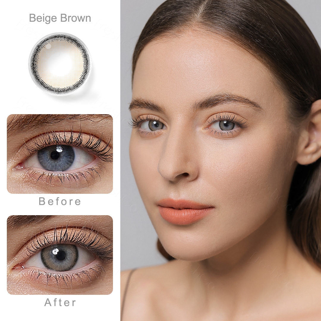 Limbal Ring Effect