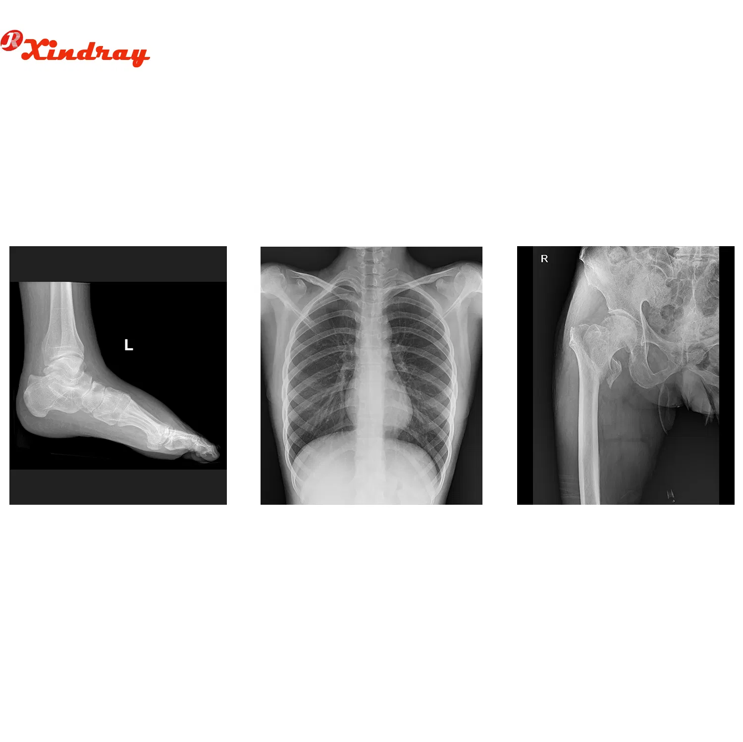 Rapid Processing X-ray Developer and Fixer Solution