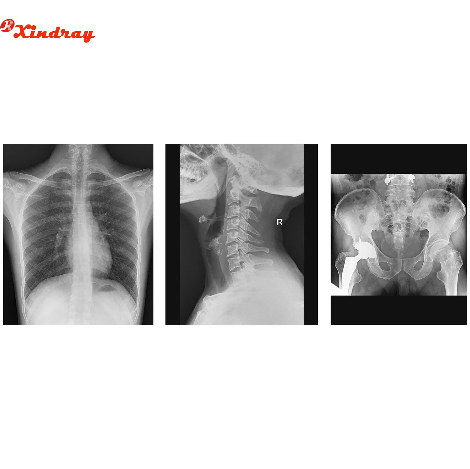 Rapid Processing X-ray Developer and Fixer Solution