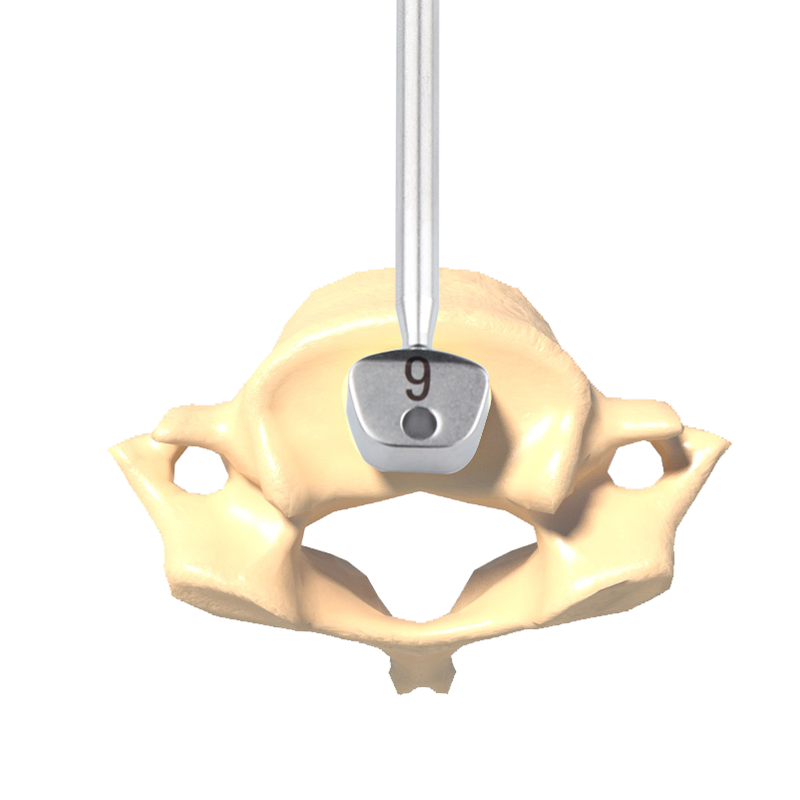 Made China Fule Miko II Manual Operation Premium Minimally Invasive Surgery Peek Anterior Cervical Cage Implantable Artificial