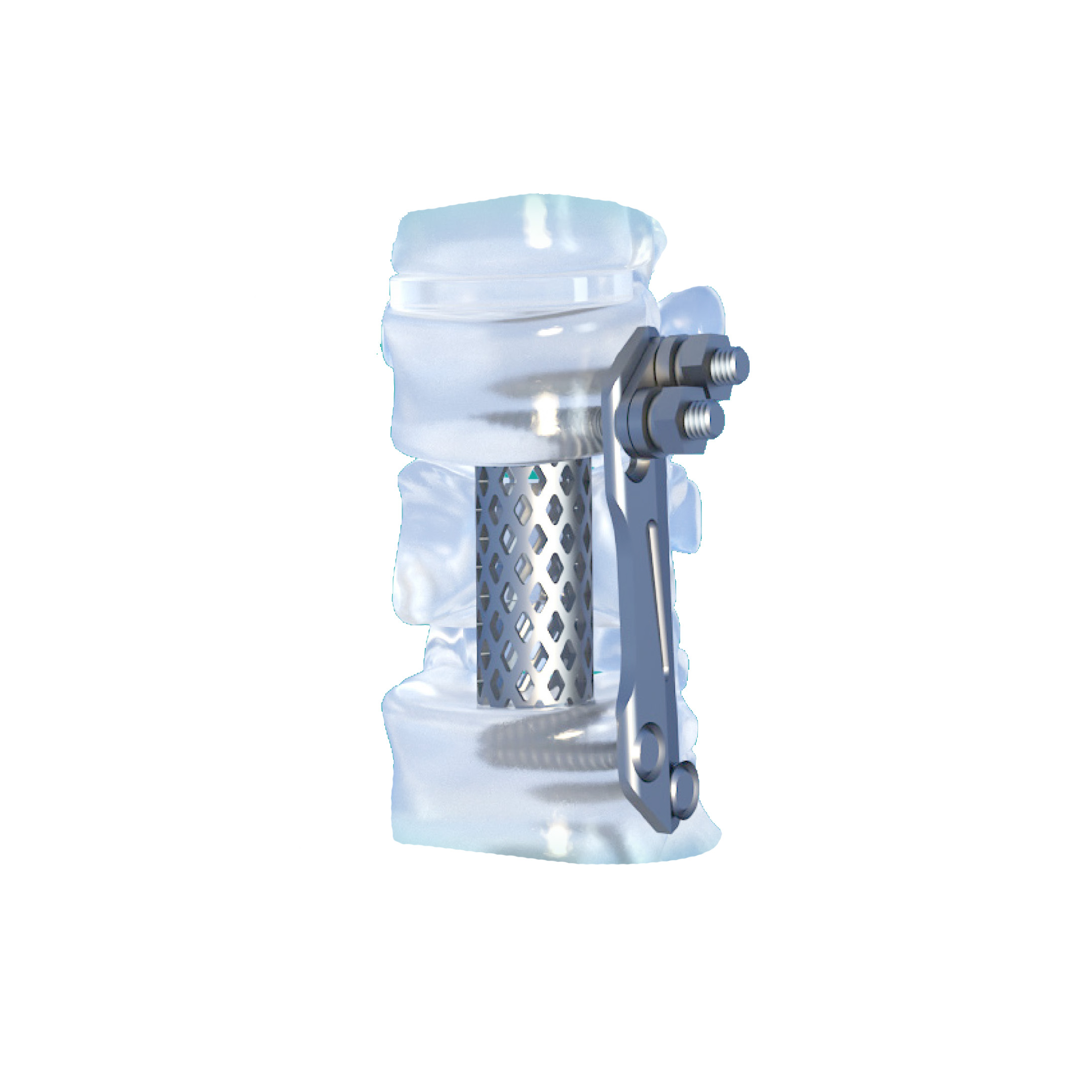 Fule Orthopedic Implant Cylindrical Interbody Fusion Cage Prismatic Hole Titanium Class III CE Certified OEM 5 Years Warranty