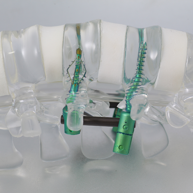 Orthopedic Surgical Titanium Implants Posterior Lumbar Interbody Fusion Cage From Beijing FULE Interventional Materials