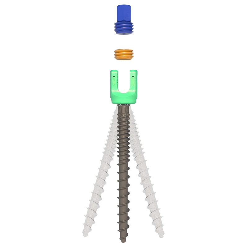 Usmart 5.5mm Titanium Spinal Screw System Most Competitive Price Made for Hospitals in China