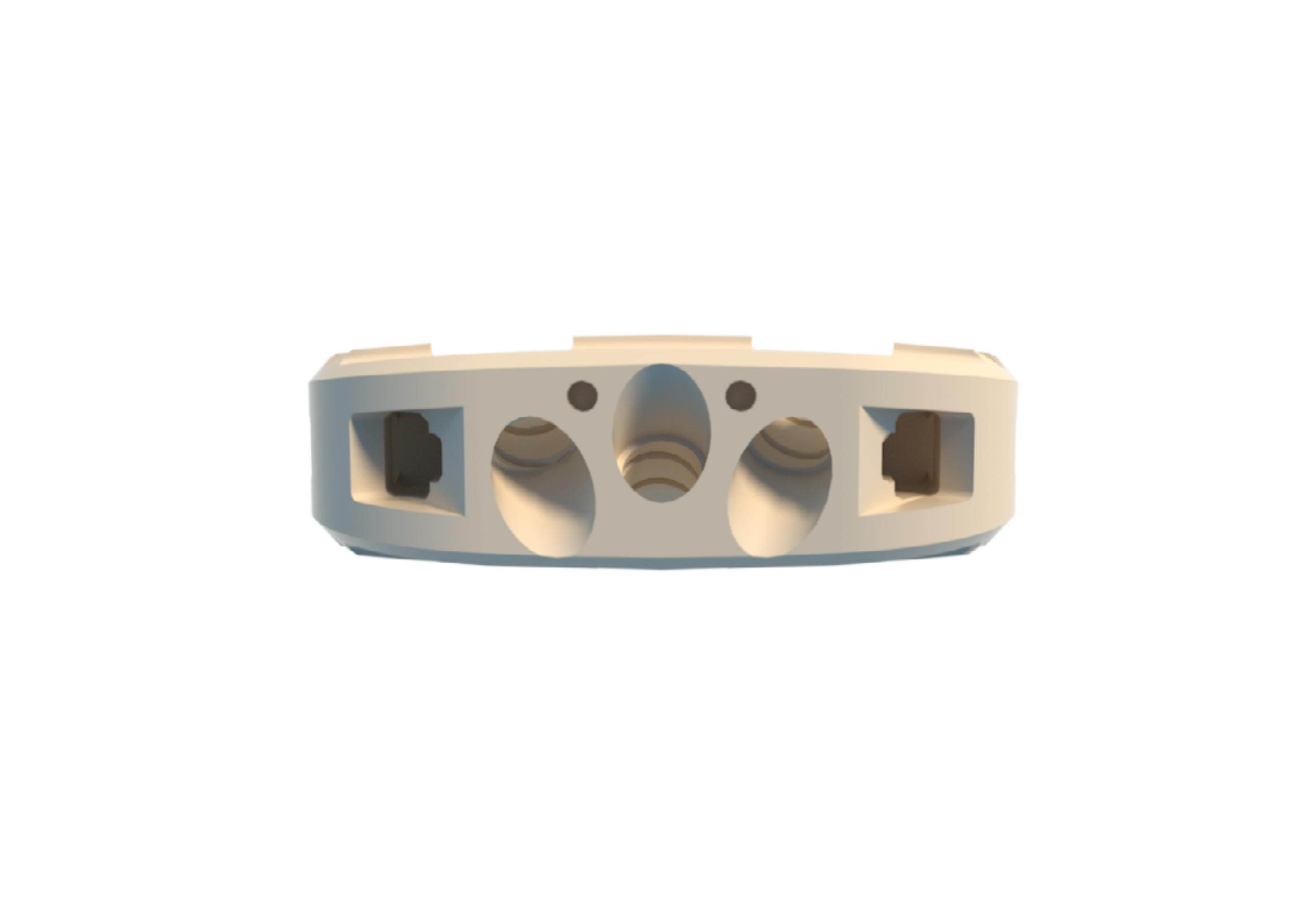 FULE Posterior Lumbar Interbody Fusion Cage Spine Orthopedic Implants ALIF PEEK Class III CE Certified 5-Year Warranty