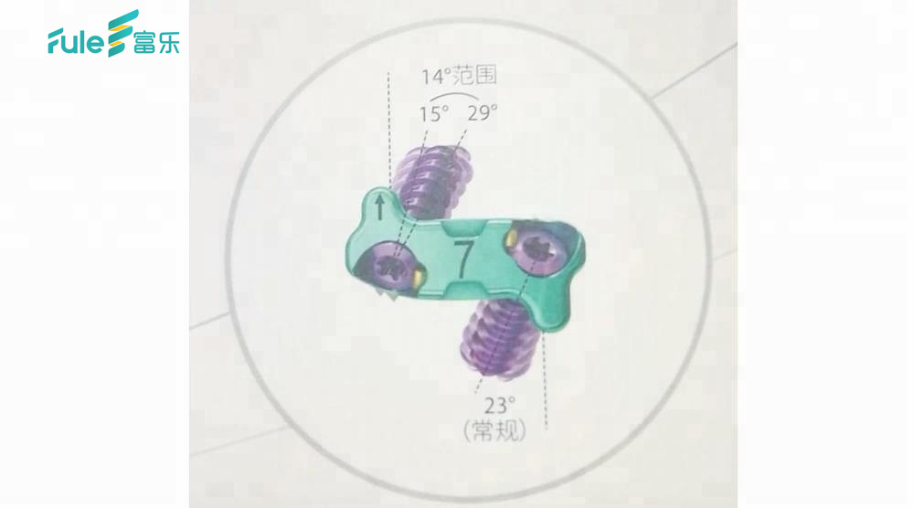 Fule Updated Product Anterior Zero-profile Interbody Cage with 2 Screws for Spinal Surgery