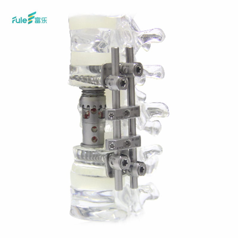 Fule Fava Titanium Artificial Vertebral Body Medical Suit System Orthopedic Surgery Implant CE/ISO13485/ISO9001 Certified