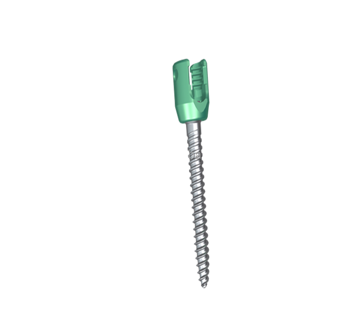 High Quality Titanium 5.5 Usmart System Expandable Reduction Pedicle Screw for Osteoporosis Treatment CE Certified
