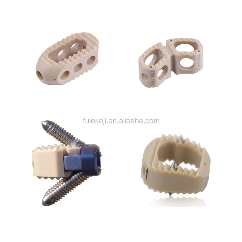 Break-off Multi-Axial Titanium Spinal Screws Spine Implants for Orthopedic Surgery Class III Medical Device CE Certified 1 Year