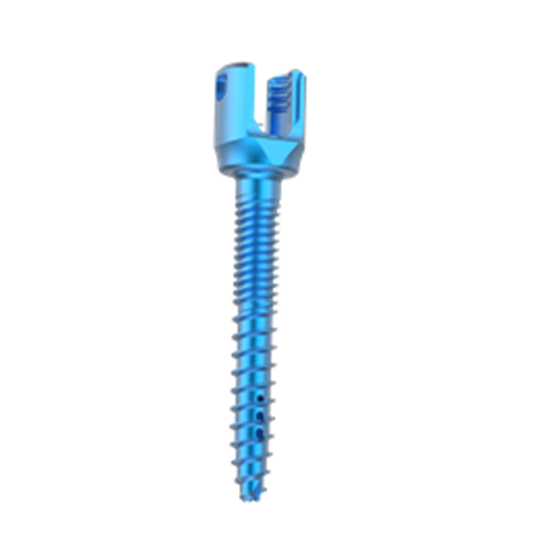 High Quality Fule Brand CE Certified Titanium Medical MikoII5.5 Class III Minimal Invasive Spine Surgery Implant 5+ Year