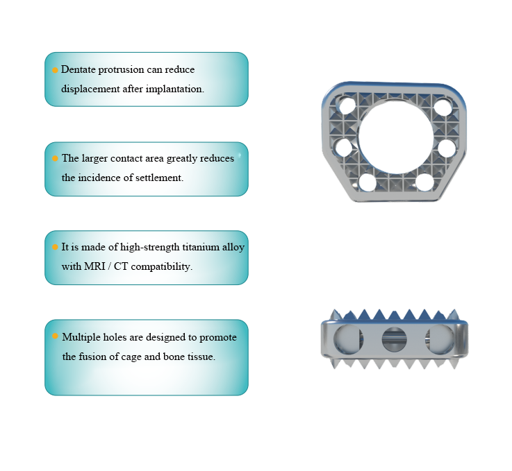 Cervical Interbody Fusion Cage Titanium Wedge-shaped & Arc-shaped for Spine Surgery