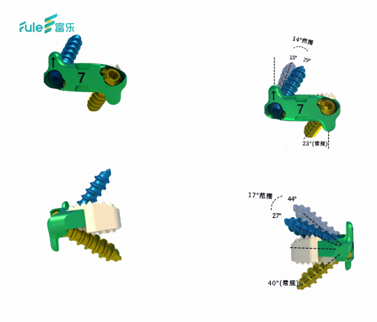 Orthopedic Surgical Implants Titanium Fedex Customized Zero Profile Anterior Cervical Cage Instruments Class III CE Certified
