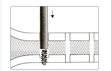Step 3