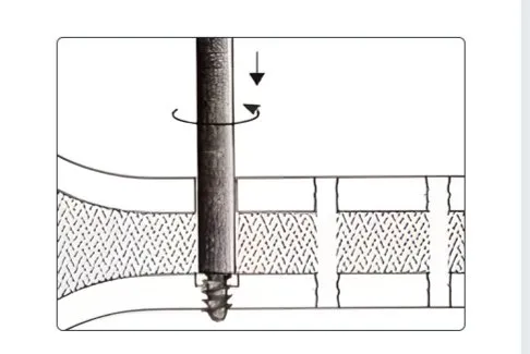 Step 2
