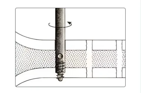Step 4