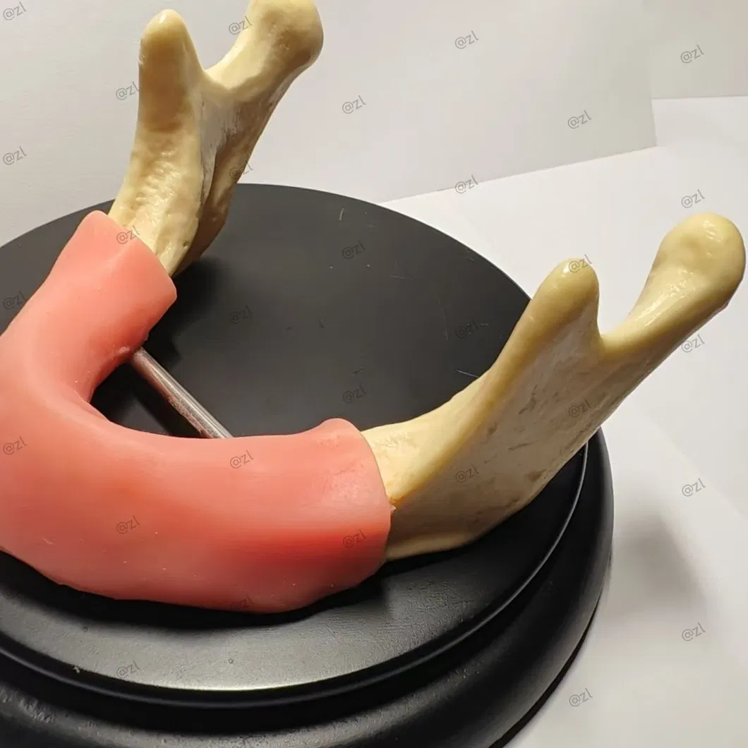 Dental Training Model 4