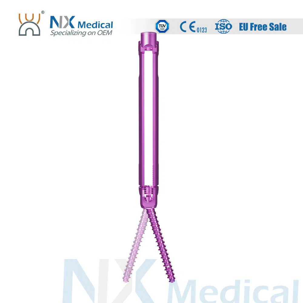 نظام برغي العمود الفقري المثقوب من Nx Medical للأطراف الاصطناعية العظمية مع الأسمنت العظمي 5.5mm