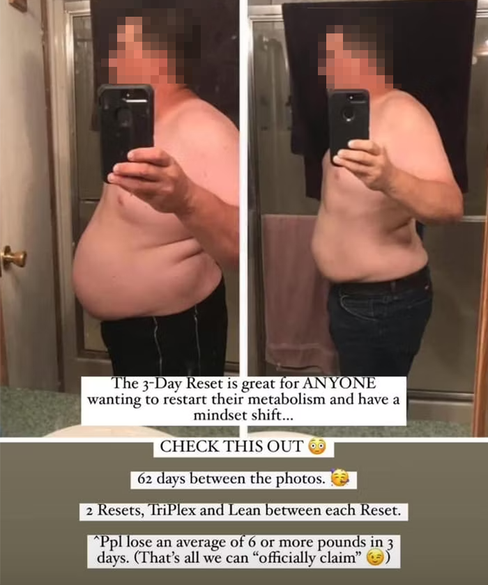 Retatrutide Power for weight loss_
