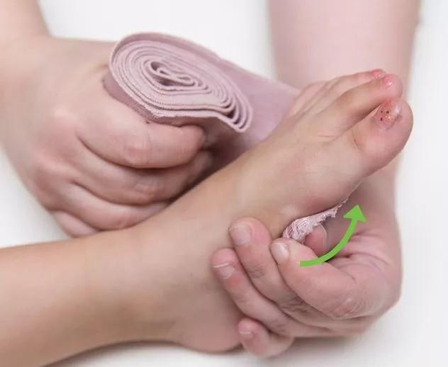 Medical Disposable Rubber/Spandex + Cotton High-Elastic Bandage CE/ISO/FDA/Sfda