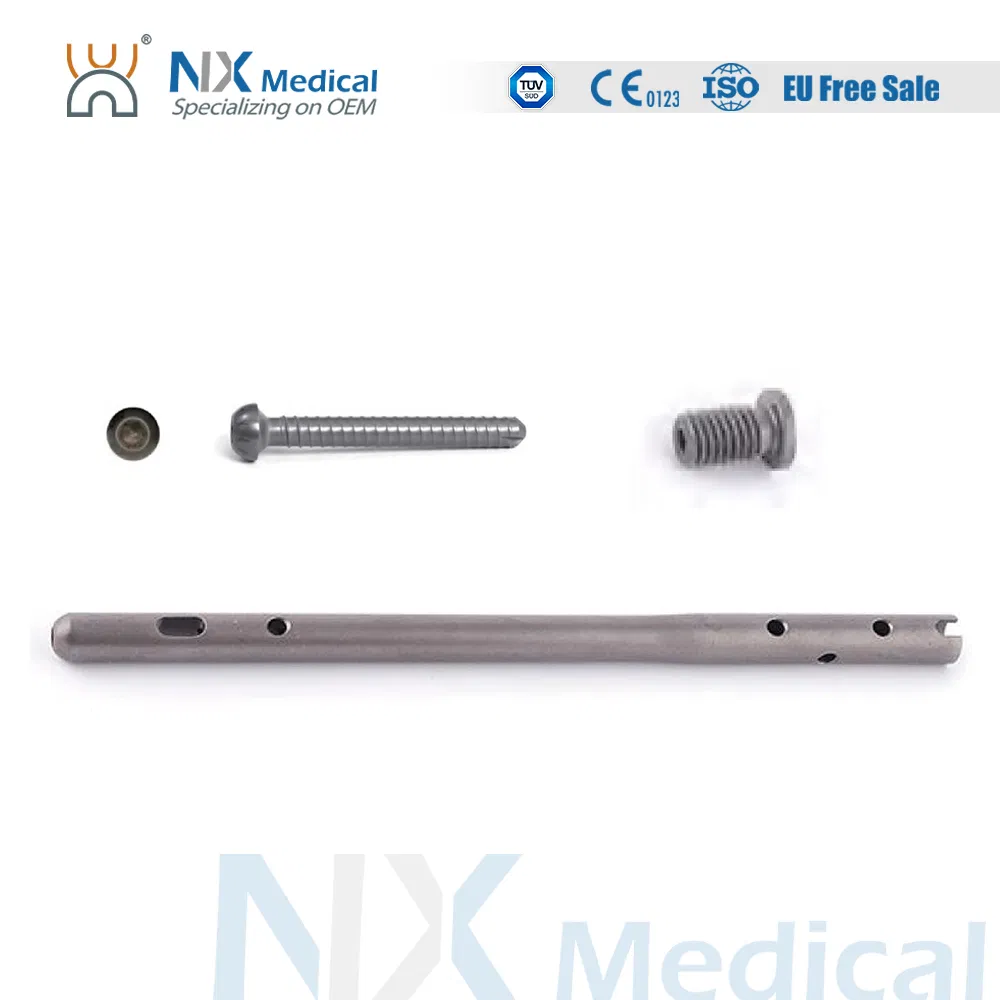 Nx Medical Premium Quality Ankle Fusion Nail Bone Fixation Interlocking Intramedullary Nail