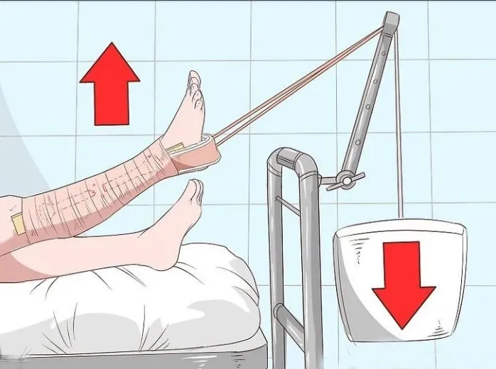 Skin Traction Kit Adult Size