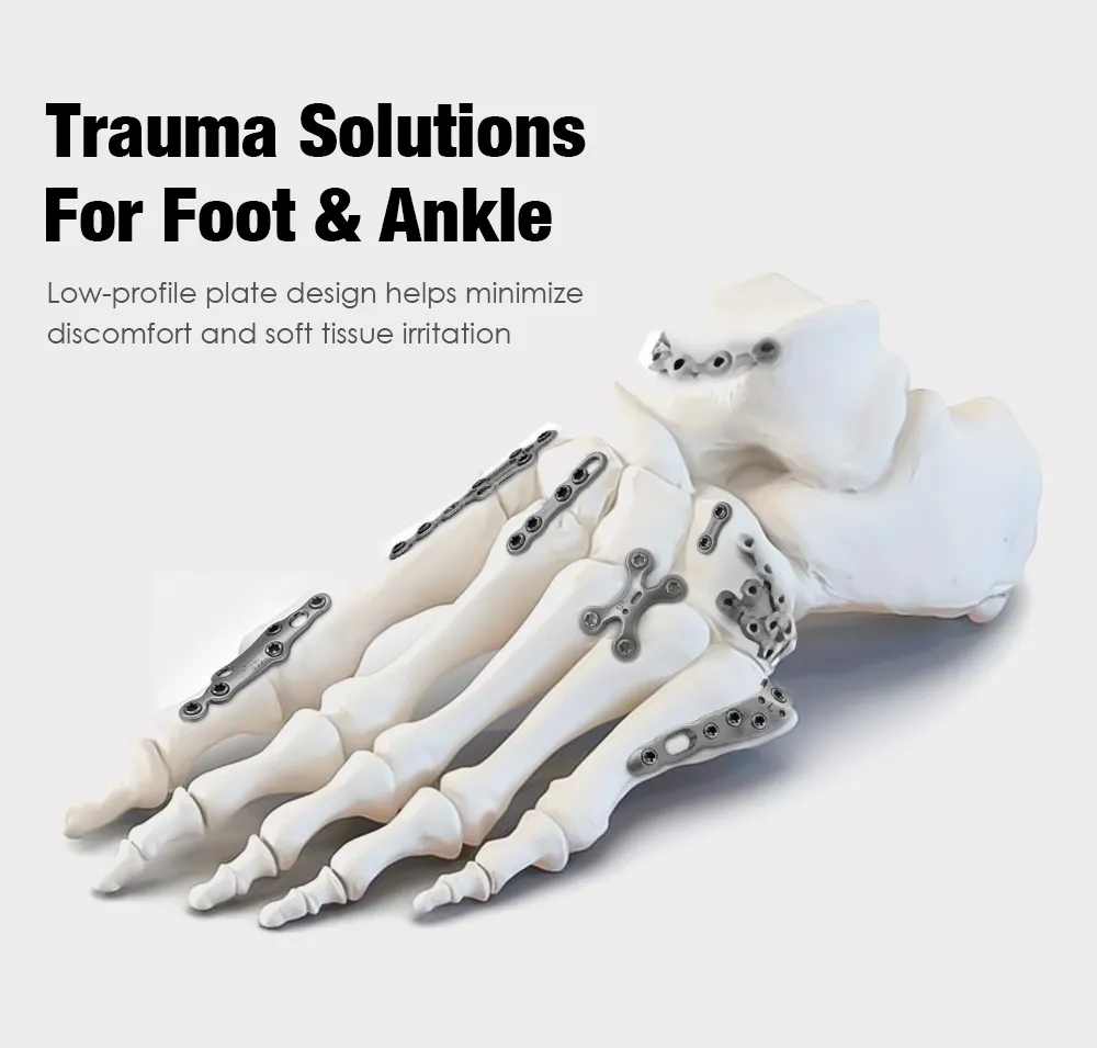 Mini Bone Locking Plate Details