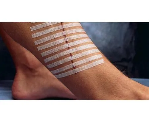 Steri-Strip Product Detail