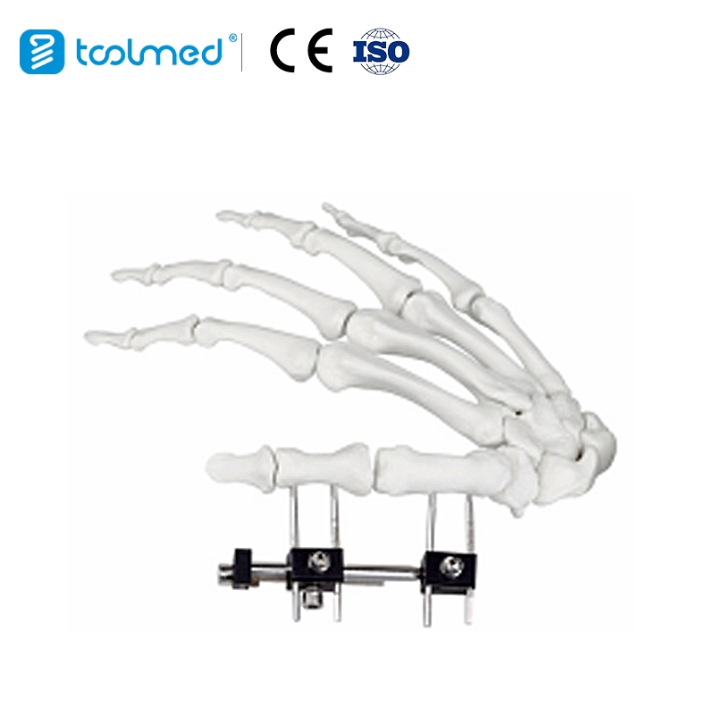 Toolmed Mini Fixator Combined Type Orthopedic External Fixator Orthopedic Device Mini Finger and Palm Fixator
