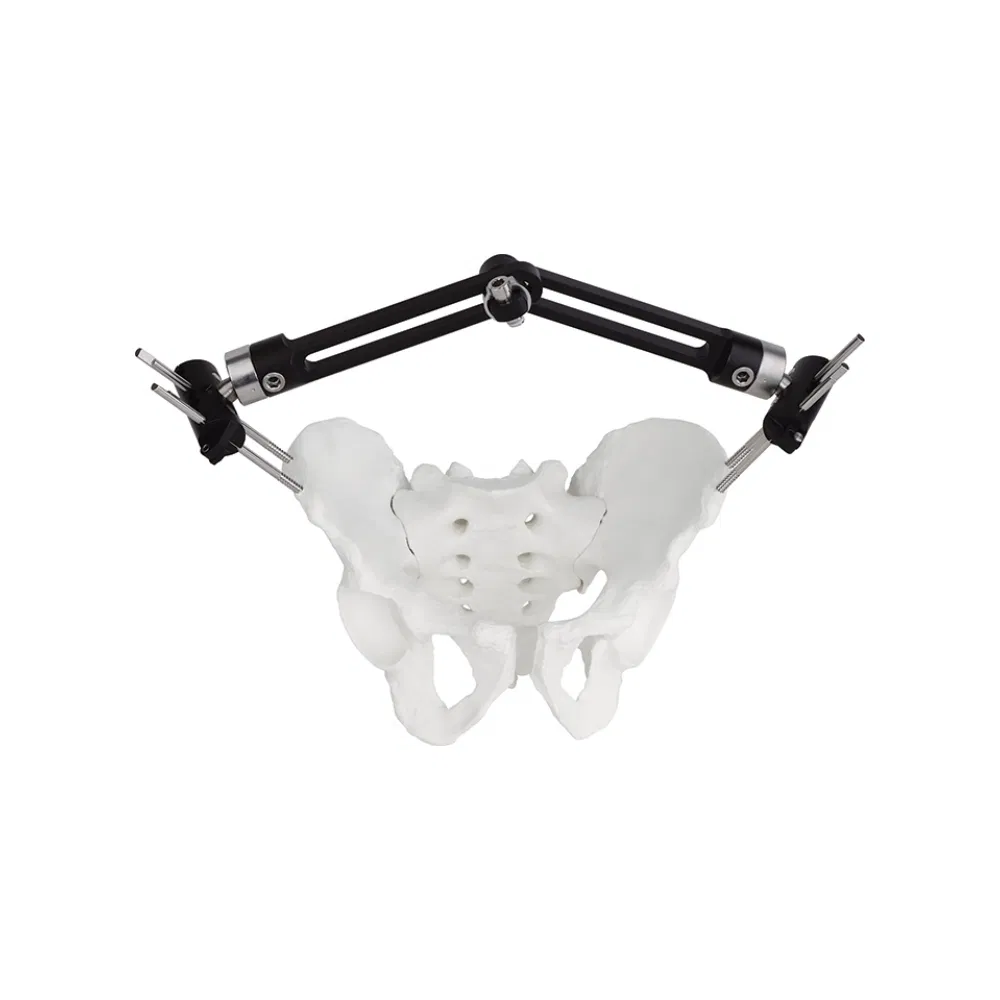 Orthopedic Surgery Pelvic External Fixator Two Section Type External Fixator