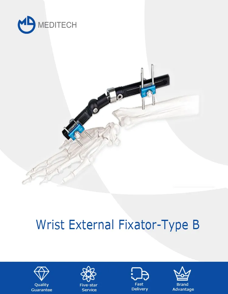 Wrist Joints External Fixator 1