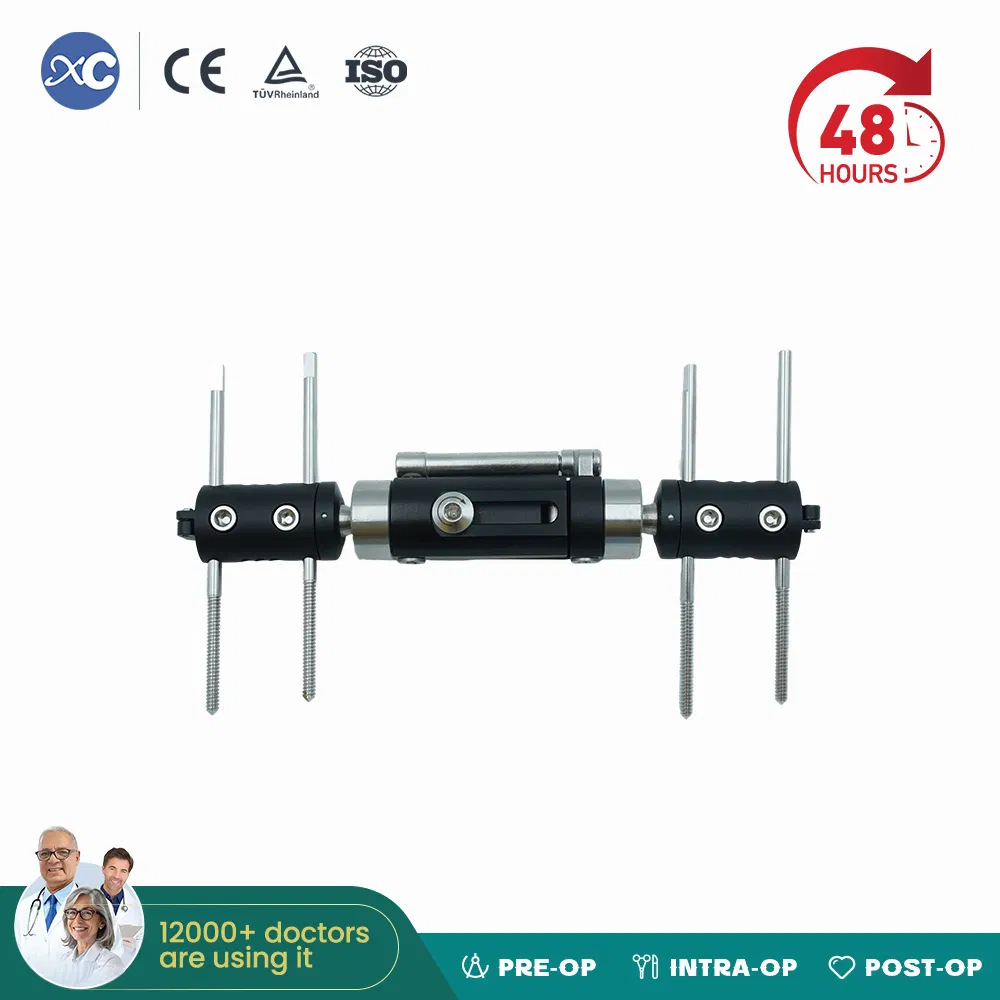 Elbow External Fixator Medium Tubular Bones Fracture Fixation Elbow Hinge Fixator